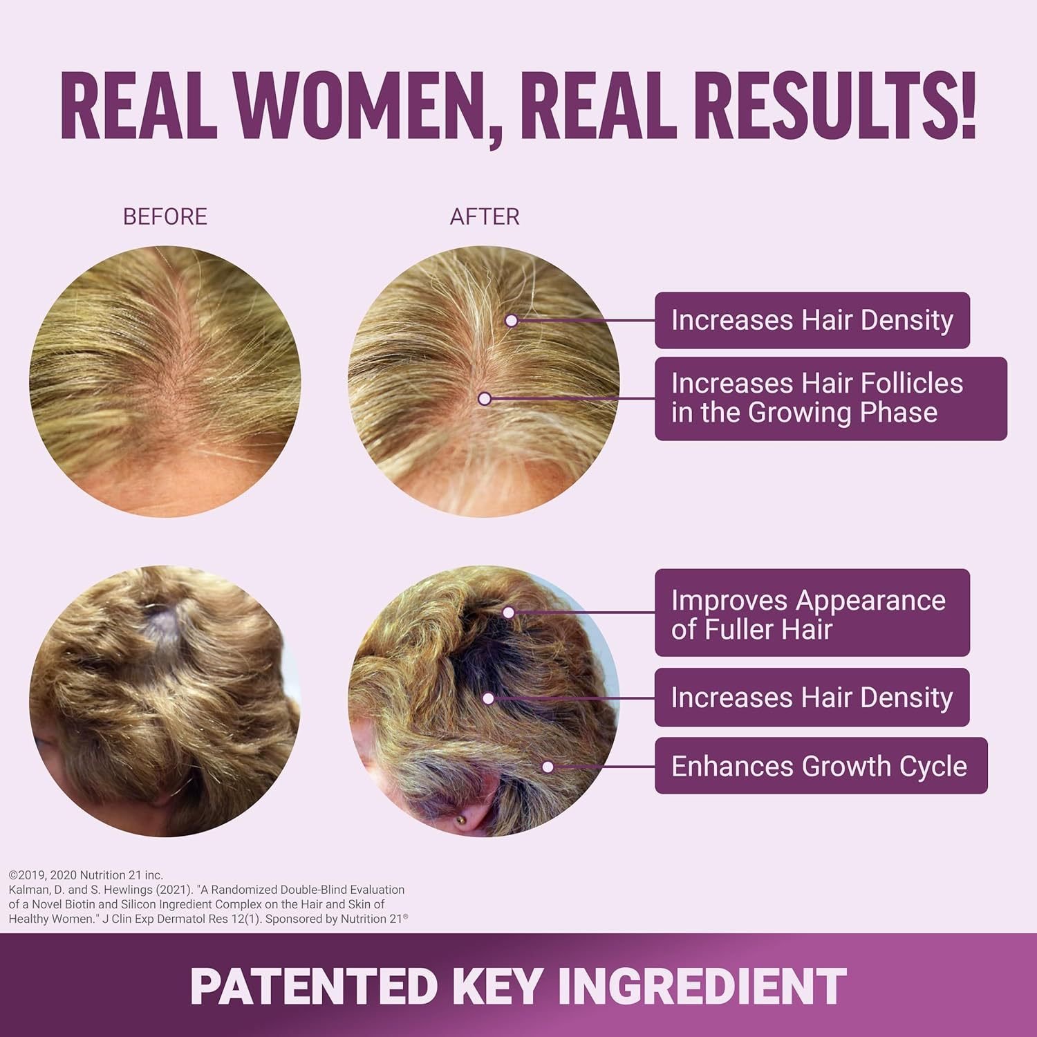 e71a3b2f-de3c-4171-a2f7-2854d6433f00jpg • Punkin's Patch Infographic showing before/after photos of women's scalps with increased hair density and growth, with labeled callouts describing density, follicles in growing phase, fuller hair, and growth cycle.
